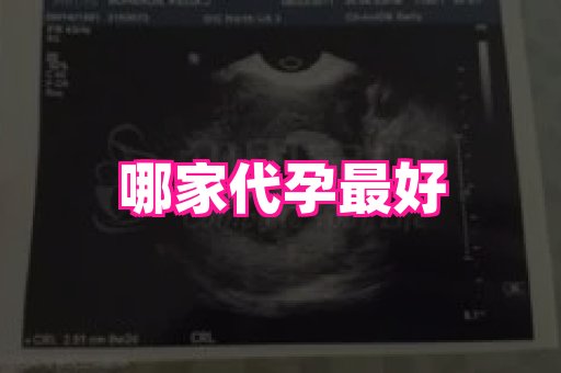 长春助孕网 4